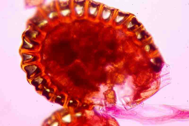 sporangium showing annulus, of Asplenium nidus 