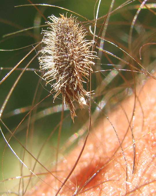 Beggar's Lice, MYOSOTIS DISCOLOR, detached calyx with hooked hairs, stuck in arm hairs