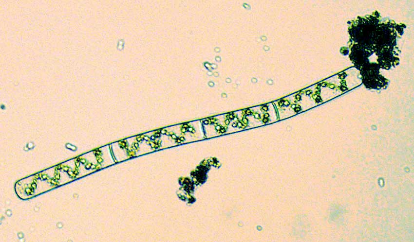 SPIROGYRA cf. COMMUNIS