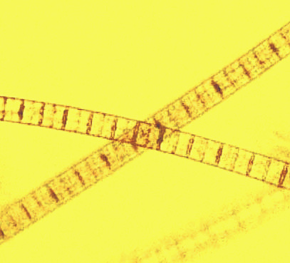 Cyanobacterium scum, possibly Oscillatoria