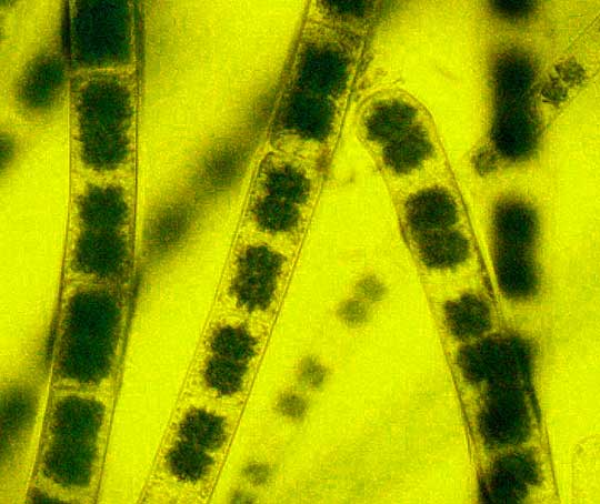 ZYGNEMA alga cells