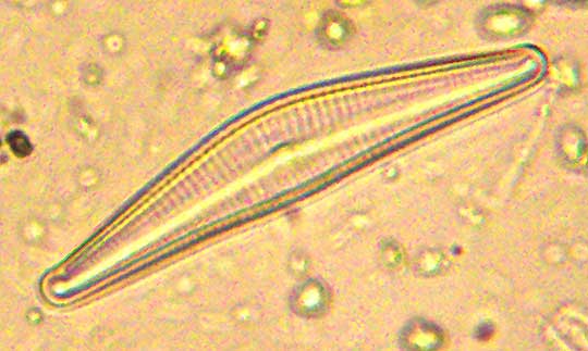 diatom, asymmetrical biraphid