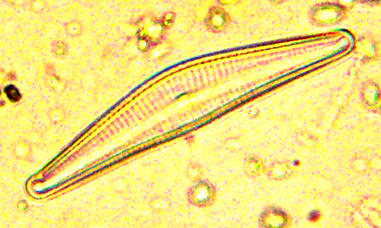 diatom, asymmetrical biraphid