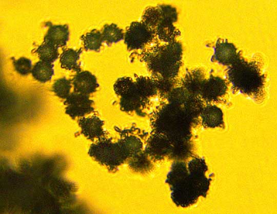 Potato Earthball, SCLERODERMA BOVISTA, spores