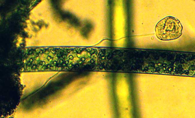 VORTICELLA