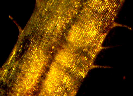 PTYCHOMITRIUM SERRATUM, leaf cell structure