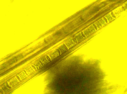 Cyanobacteria, different stages of development