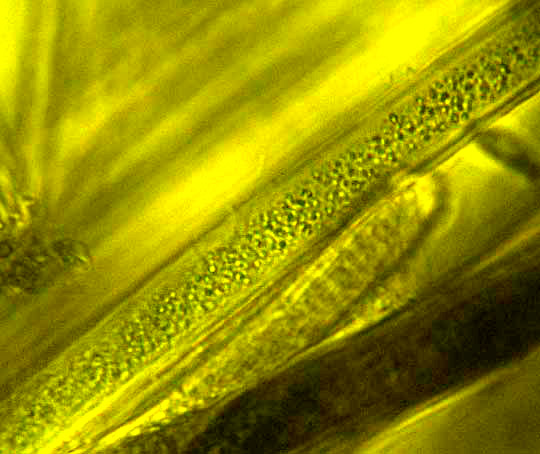 Cyanobacterium filament