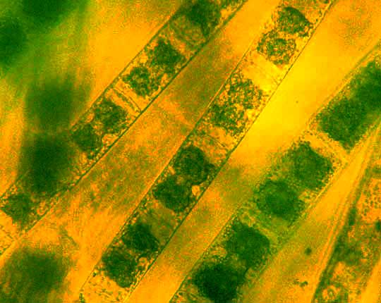 ZYGNEMA alga, cells showing chloroplasts