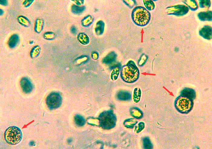 HAEMATOCOCCUS PLUVIALIS