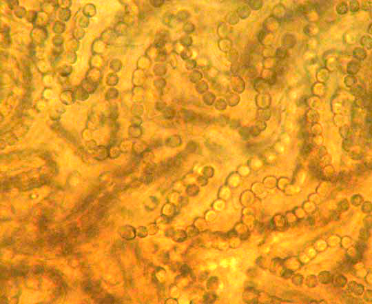 NOSTOC COMMUNE cells