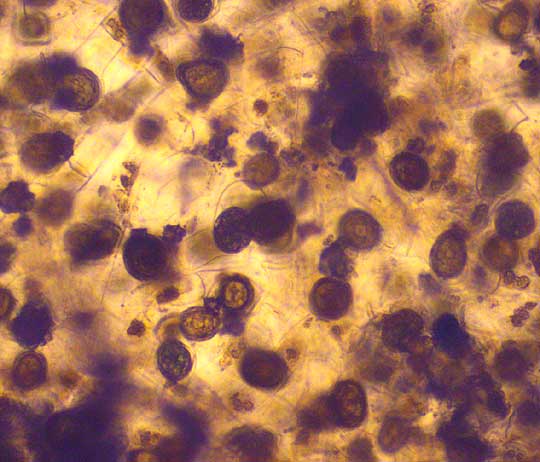 ZYGNEMA alga, zygospores