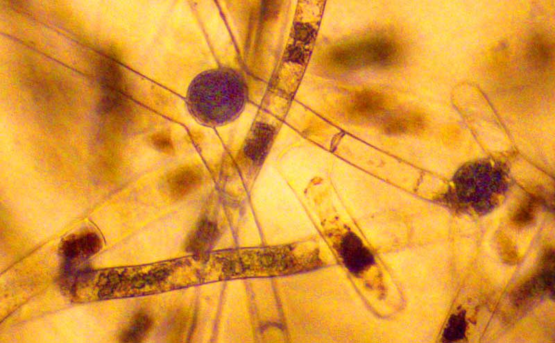 Zygnema zygospores in different stages of forming