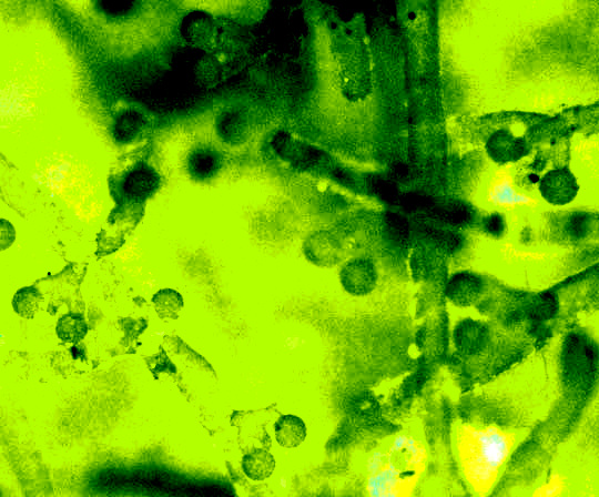 Green Felt, VAUCHERIA cf. GEMINATA, filaments bearing spores