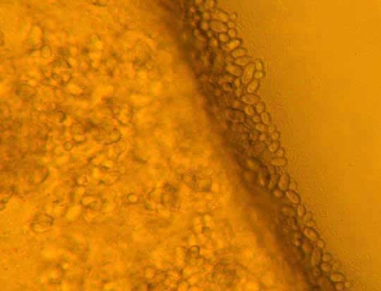 Yeast cells