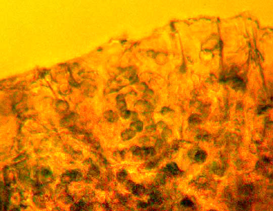 Microscopic Nostoc cells in jelly Lichen, COLLEMA cf. POLYCARPON