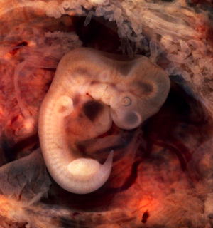 human embryo, 7th week of pregnancy; image courtesy of Ed Uthman of Texas and Wikimedia Commons