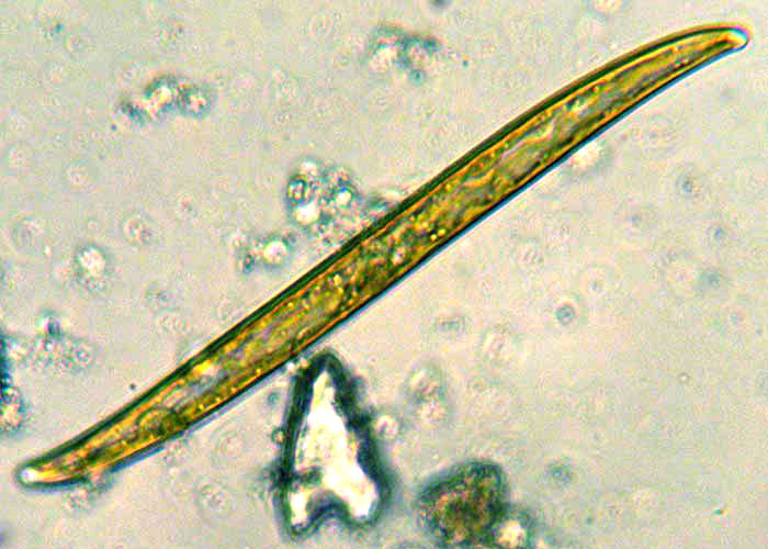 Pennate diatom